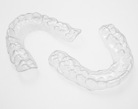 Removable Retainers